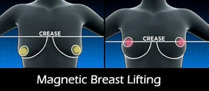 Instant Magnetic Therapy Breast Lift Bra Inserts