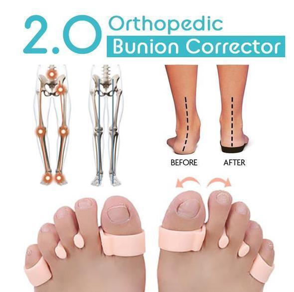 Orthopedic Bunion Corrector 2.0 (2 pcs)